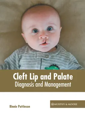 Rozszczep wargi i podniebienia: Diagnoza i leczenie - Cleft Lip and Palate: Diagnosis and Management