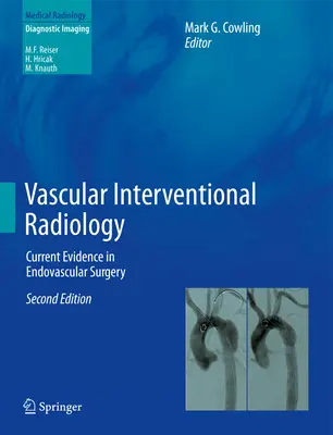 Interwencyjna radiologia naczyniowa: Aktualne dowody w chirurgii wewnątrznaczyniowej - Vascular Interventional Radiology: Current Evidence in Endovascular Surgery