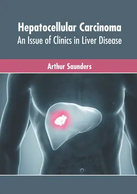 Rak wątrobowokomórkowy: wydanie Clinics in Liver Disease - Hepatocellular Carcinoma: An Issue of Clinics in Liver Disease