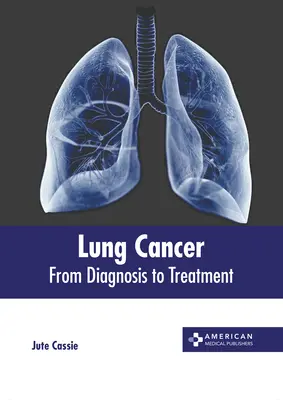 Rak płuc: Od diagnozy do leczenia - Lung Cancer: From Diagnosis to Treatment