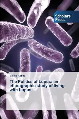 Polityka tocznia: etnograficzne studium życia z toczniem - The Politics of Lupus: an ethnographic study of living with Lupus