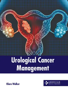 Leczenie nowotworów urologicznych - Urological Cancer Management