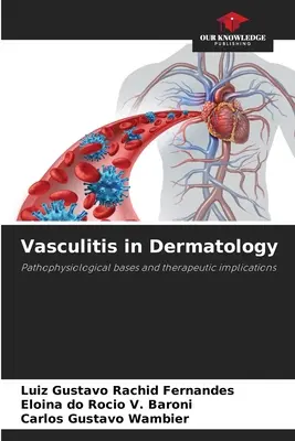 Zapalenie naczyń w dermatologii - Vasculitis in Dermatology