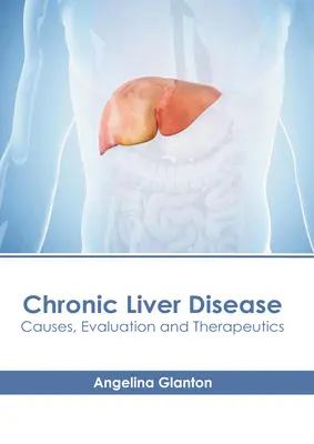 Przewlekła choroba wątroby: Przyczyny, ocena i leczenie - Chronic Liver Disease: Causes, Evaluation and Therapeutics