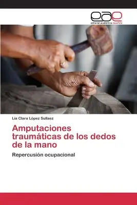 Amputaciones traumticas de los dedos de la mano