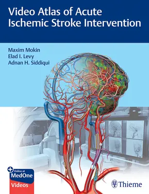 Atlas wideo interwencji w ostrym udarze niedokrwiennym mózgu - Video Atlas of Acute Ischemic Stroke Intervention