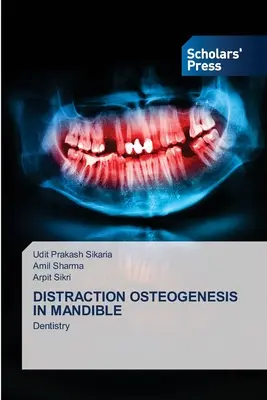 Osteogeneza dystrakcyjna w żuchwie - Distraction Osteogenesis in Mandible