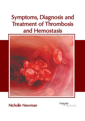 Objawy, diagnostyka i leczenie zakrzepicy i hemostazy - Symptoms, Diagnosis and Treatment of Thrombosis and Hemostasis