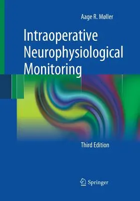 Śródoperacyjne monitorowanie neurofizjologiczne - Intraoperative Neurophysiological Monitoring