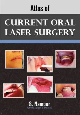 Atlas aktualnej chirurgii laserowej jamy ustnej - Atlas of Current Oral Laser Surgery