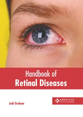 Podręcznik chorób siatkówki - Handbook of Retinal Diseases