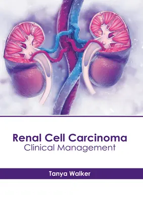 Rak nerkowokomórkowy: postępowanie kliniczne - Renal Cell Carcinoma: Clinical Management