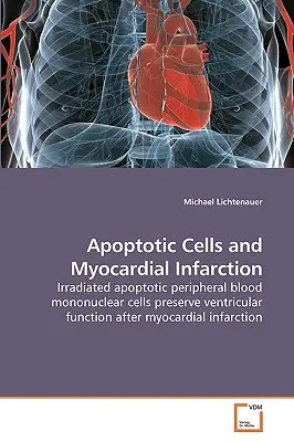 Komórki apoptotyczne i zawał mięśnia sercowego - Apoptotic Cells and Myocardial Infarction