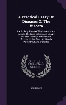 Praktyczny esej na temat chorób trzewi: Szczególnie te z żołądka i jelit, wątroby, śledziony i pęcherza moczowego: w których ich Nat - A Practical Essay On Diseases Of The Viscera: Particularly Those Of The Stomach And Bowels, The Liver, Spleen, And Urinary Bladder: In Which Their Nat