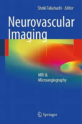 Neurovascular Imaging: MRI i mikroangiografia - Neurovascular Imaging: MRI & Microangiography