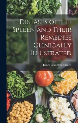 Choroby śledziony i ich leczenie zilustrowane klinicznie - Diseases of the Spleen and Their Remedies Clinically Illustrated