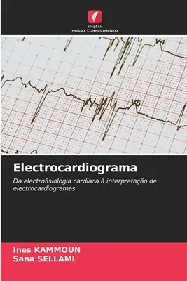 Elektrokardiogram - Electrocardiograma