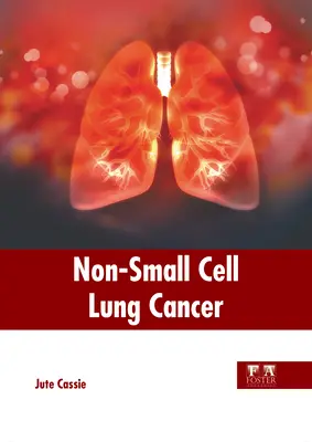 Niedrobnokomórkowy rak płuca - Non-Small Cell Lung Cancer