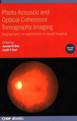 Fotoakustyczna i optyczna koherentna tomografia obrazowa: Angiografia: zastosowanie w obrazowaniu naczyń krwionośnych - Photo Acoustic and Optical Coherence Tomography Imaging: Angiography: - An Application in Vessel Imaging