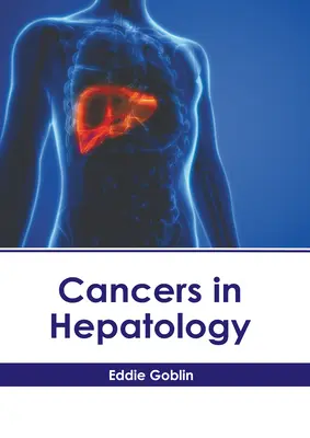 Nowotwory w hepatologii - Cancers in Hepatology