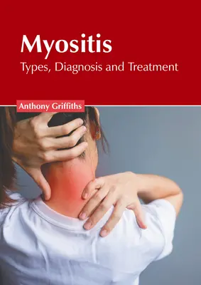 Zapalenie mięśni: Rodzaje, diagnoza i leczenie - Myositis: Types, Diagnosis and Treatment