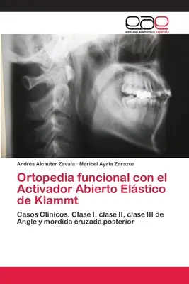 Ortopedia funkcjonalna z aktywatorem Abierto Elstico de Klammt - Ortopedia funcional con el Activador Abierto Elstico de Klammt