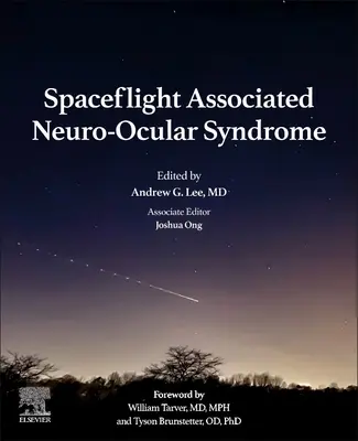 Zespół neuro-okulistyczny związany z lotami kosmicznymi - Spaceflight Associated Neuro-Ocular Syndrome