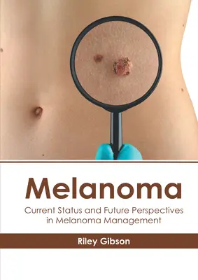 Czerniak: aktualny stan i perspektywy na przyszłość w leczeniu czerniaka - Melanoma: Current Status and Future Perspectives in Melanoma Management