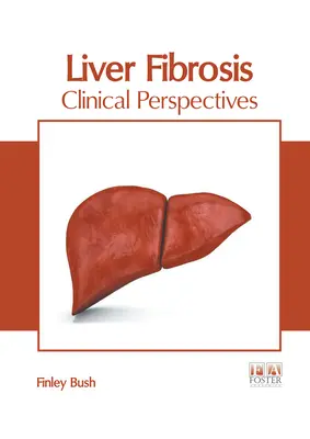 Zwłóknienie wątroby: Perspektywy kliniczne - Liver Fibrosis: Clinical Perspectives