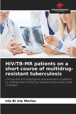 Pacjenci HIV/TB-MR na krótkim kursie gruźlicy wielolekoopornej - HIV/TB-MR patients on a short course of multidrug-resistant tuberculosis