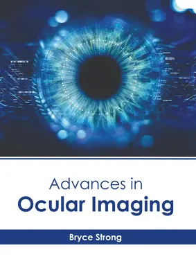 Postępy w obrazowaniu oka - Advances in Ocular Imaging