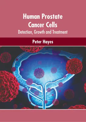 Ludzkie komórki raka prostaty: Wykrywanie, wzrost i leczenie - Human Prostate Cancer Cells: Detection, Growth and Treatment