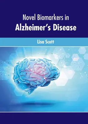 Nowe biomarkery w chorobie Alzheimera - Novel Biomarkers in Alzheimer's Disease