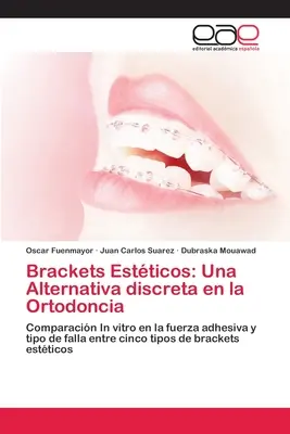 Brackets Estticos: Dyskretna alternatywa dla ortodoncji - Brackets Estticos: Una Alternativa discreta en la Ortodoncia