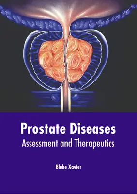 Choroby prostaty: Ocena i terapia - Prostate Diseases: Assessment and Therapeutics