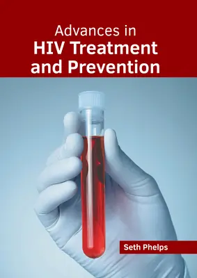 Postępy w leczeniu i zapobieganiu HIV - Advances in HIV Treatment and Prevention