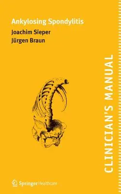 Podręcznik klinicysty dotyczący zesztywniającego zapalenia stawów kręgosłupa - Clinician's Manual on Ankylosing Spondylitis