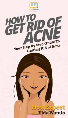 Jak pozbyć się trądziku: przewodnik krok po kroku, jak pozbyć się trądziku - How To Get Rid of Acne: Your Step By Step Guide To Getting Rid of Acne