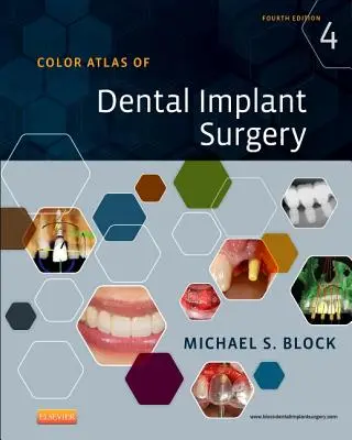 Kolorowy atlas chirurgii implantów dentystycznych - Color Atlas of Dental Implant Surgery