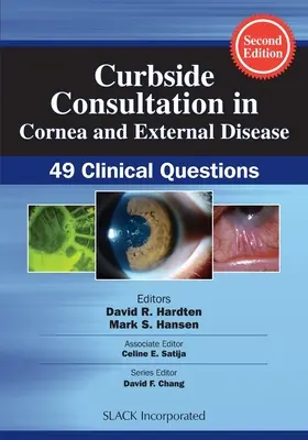 Konsultacje przy krawężniku w zakresie rogówki i chorób zewnętrznych: 49 pytań klinicznych - Curbside Consultation in Cornea and External Disease: 49 Clinical Questions