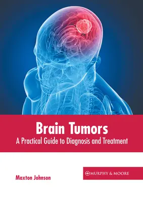 Guzy mózgu: Praktyczny przewodnik po diagnostyce i leczeniu - Brain Tumors: A Practical Guide to Diagnosis and Treatment