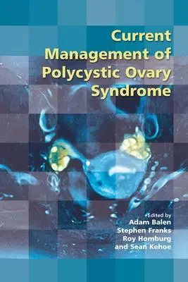 Aktualne zarządzanie zespołem policystycznych jajników - Current Management of Polycystic Ovary Syndrome