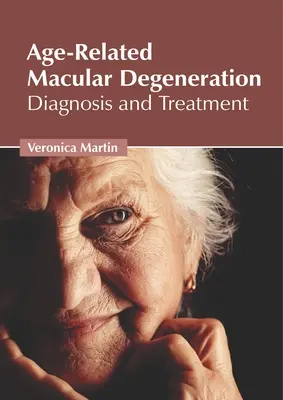 Zwyrodnienie plamki żółtej związane z wiekiem: Diagnoza i leczenie - Age-Related Macular Degeneration: Diagnosis and Treatment