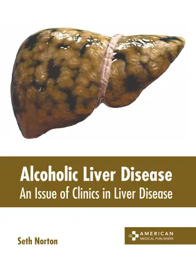 Alkoholowa choroba wątroby: Wydanie Clinics in Liver Disease - Alcoholic Liver Disease: An Issue of Clinics in Liver Disease