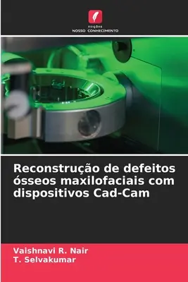 Rekonstrukcja uszkodzeń maxilofaciais za pomocą urządzeń Cad-Cam - Reconstruo de defeitos sseos maxilofaciais com dispositivos Cad-Cam