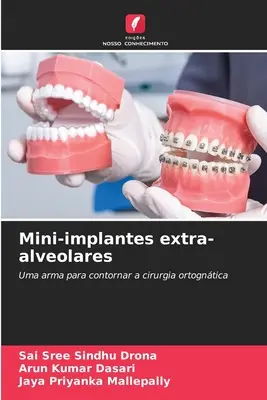 Mini-implanty pozapęcherzykowe - Mini-implantes extra-alveolares