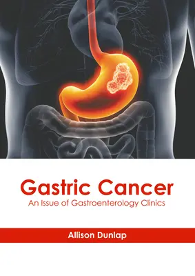 Rak żołądka: Wydanie klinik gastroenterologicznych - Gastric Cancer: An Issue of Gastroenterology Clinics