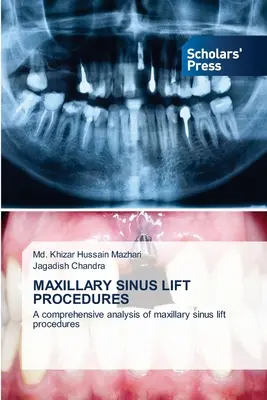 Procedury podnoszenia zatok szczękowych - Maxillary Sinus Lift Procedures