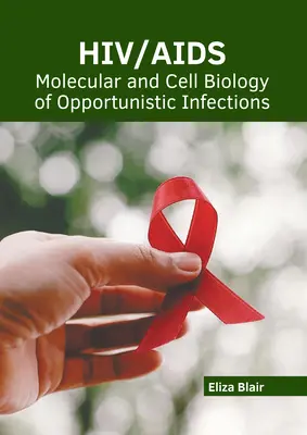 Hiv/Aids: Biologia molekularna i komórkowa zakażeń oportunistycznych - Hiv/Aids: Molecular and Cell Biology of Opportunistic Infections