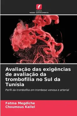 Avaliao das exigncias de avaliao da trombofilia no Sul da Tunsia